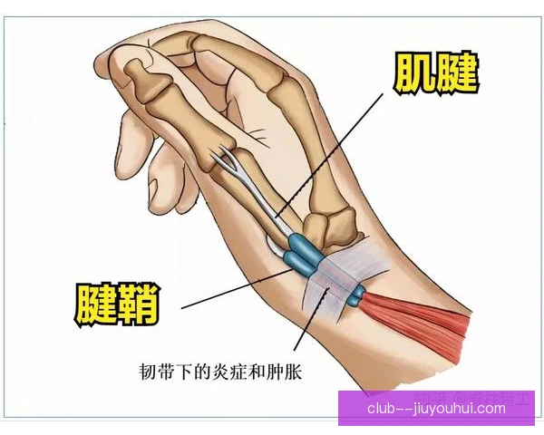 皇室战争腱鞘炎防护，科学操作减轻手腕负担